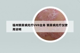 福州银屑病光疗UVB全身 银屑病光疗仪使用说明