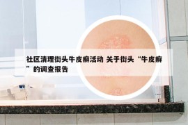 社区清理街头牛皮癣活动 关于街头“牛皮癣”的调查报告