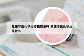 氟康唑氯化钠治疗银屑病吗 氟康唑氯化钠治疗什么