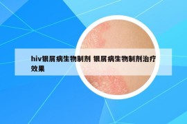 hiv银屑病生物制剂 银屑病生物制剂治疗效果