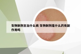 生物制剂主治什么病 生物制剂是什么药有副作用吗