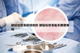 肤轻松软膏的功效的 肤轻松软膏能长期使用吗