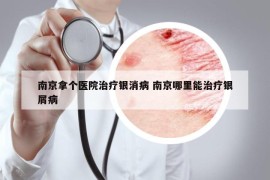 南京拿个医院治疗银消病 南京哪里能治疗银屑病