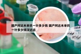 国产阿达木单抗一针多少钱 国产阿达木单抗一针多少钱汉达运