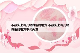 小孩头上有几块白色的地方 小孩头上有几块白色的地方不长头发