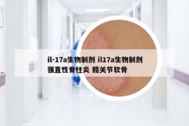 il-17a生物制剂 il17a生物制剂强直性脊柱炎 髋关节软骨