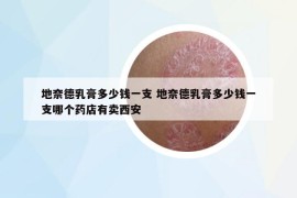 地奈德乳膏多少钱一支 地奈德乳膏多少钱一支哪个药店有卖西安