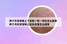 两个月宝宝嘴上下皮肤一块一块白怎么回事 两个月的宝宝嘴上起白皮是怎么回事