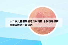 十二岁儿童银屑病吃什M钙片 十岁孩子银屑病建议吃药还是抹药