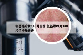 氨基蝶呤片100片价格 氨基蝶呤片100片价格是多少