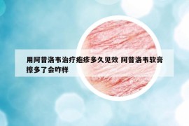 用阿昔洛韦治疗疱疹多久见效 阿昔洛韦软膏擦多了会咋样