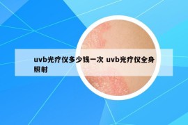 uvb光疗仪多少钱一次 uvb光疗仪全身照射
