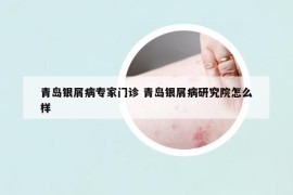 青岛银屑病专家门诊 青岛银屑病研究院怎么样