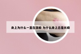 身上为什么一直在涨癣 为什么身上总是长癣