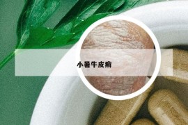 小暑牛皮癣