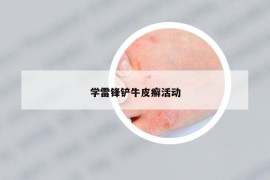 学雷锋铲牛皮癣活动