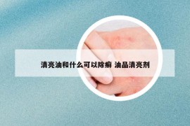 清亮油和什么可以除癣 油品清亮剂