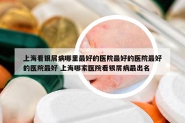 上海看银屑病哪里最好的医院最好的医院最好的医院最好 上海哪家医院看银屑病最出名