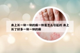 身上长一块一块的癣一样是怎么引起的 身上长了好多一块一块的癣
