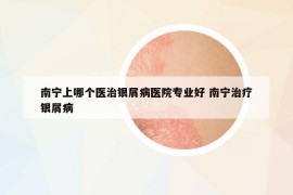 南宁上哪个医治银屑病医院专业好 南宁治疗银屑病