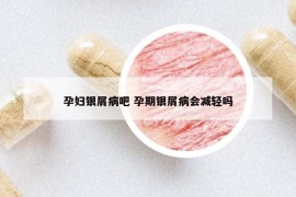孕妇银屑病吧 孕期银屑病会减轻吗