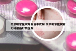 南京哪家医院专业治牛皮癣 南京哪家医院看妇科病最好的医院