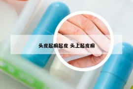 头皮起癣起皮 头上起皮癣