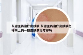 长健医药治疗皮肤病 长健医药治疗皮肤病怎样网上的一些皮肤病治疗好吗
