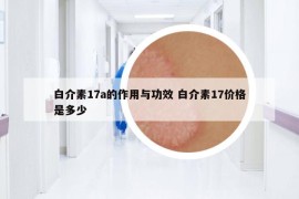 白介素17a的作用与功效 白介素17价格是多少