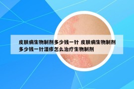 皮肤病生物制剂多少钱一针 皮肤病生物制剂多少钱一针湿疹怎么治疗生物制剂