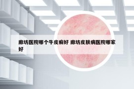 廊坊医院哪个牛皮癣好 廊坊皮肤病医院哪家好