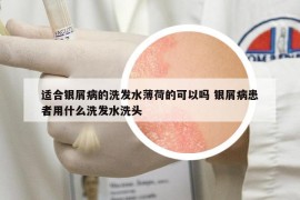 适合银屑病的洗发水薄荷的可以吗 银屑病患者用什么洗发水洗头