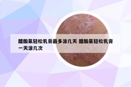 醋酸氟轻松乳膏最多涂几天 醋酸氟轻松乳膏一天涂几次