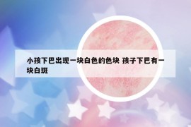 小孩下巴出现一块白色的色块 孩子下巴有一块白斑