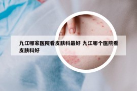 九江哪家医院看皮肤科最好 九江哪个医院看皮肤科好