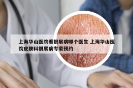 上海华山医院看银屑病哪个医生 上海华山医院皮肤科银屑病专家预约