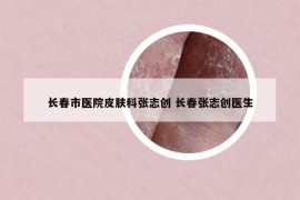 长春市医院皮肤科张志创 长春张志创医生