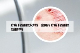 疗癣卡西甫散多少钱一盒国药 疗癣卡西甫散效果好吗