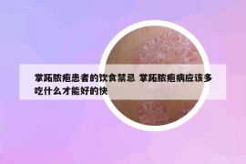 掌跖脓疱患者的饮食禁忌 掌跖脓疱病应该多吃什么才能好的快
