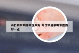 海口银屑病哪家医院好 海口银屑病哪家医院好一点
