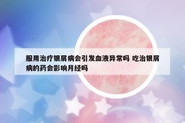 服用治疗银屑病会引发血液异常吗 吃治银屑病的药会影响月经吗