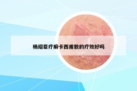 杨绍臣疗癣卡西甫散的疗效好吗