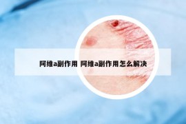 阿维a副作用 阿维a副作用怎么解决