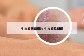 牛皮廨初期图片 牛皮廨早期图