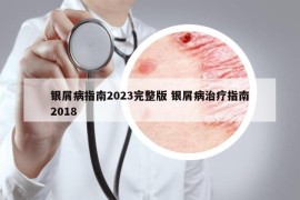 银屑病指南2023完整版 银屑病治疗指南2018