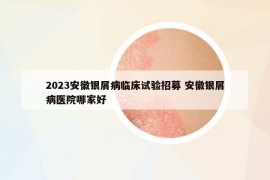 2023安徽银屑病临床试验招募 安徽银屑病医院哪家好