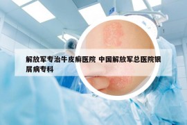 解放军专治牛皮癣医院 中国解放军总医院银屑病专科