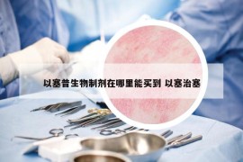 以塞普生物制剂在哪里能买到 以塞治塞