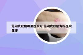芜湖皮肤病哪里医院好 芜湖皮肤病专科医院在哪