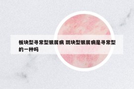 板块型寻常型银屑病 斑块型银屑病是寻常型的一种吗